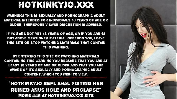 Hotkinkyjo sefl anal fisting her ruined anus hole and prolapse
